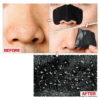 HOLIKA HOLIKA Pig-Nose Clear Black Head 3-Step Kit Strong (1 Set) 韩国HOLIKA HOLIKA 猪鼻贴去黑头三部曲套装 加强版 1件入 - Image 3