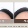 MOSTORY Mogeundan Anti Hair Loss Root Strengthen Shampoo Ball 韩国MOSTORY 强健发根防脱洗发皂 100g - Image 5